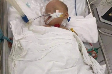 Kinh hoàng những vụ cố ý đâm đinh vào đầu trẻ