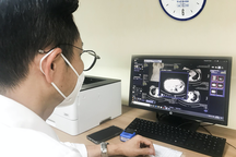 Bị sán lá gan nguy hiểm, tưởng "hậu Covid-19"