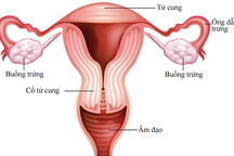 Các giai đoạn của ung thư âm hộ