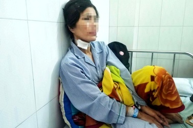 Khởi tố người chồng bạo hành dã man, cắt tai vợ cũ