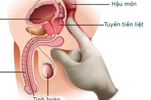 3 dấu hiệu nhiều nam giới hay gặp, đừng bỏ qua