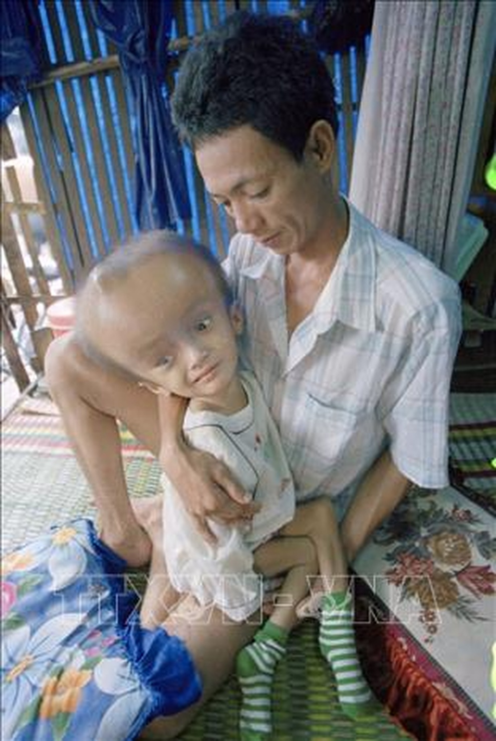 Thảm họa da cam ở Việt Nam: Cuộc chiến thảm khốc! - 5 Thảm họa da cam ở Việt Nam: Cuộc chiến thảm khốc! - 5