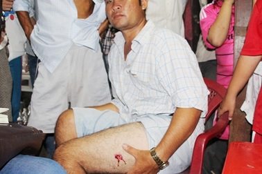 Công an nổ súng bắt sòng bạc, một người bị trúng đạn