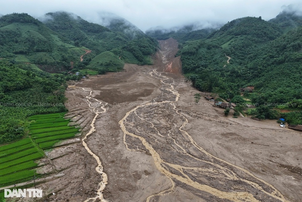50 ngày dùng phác đồ chưa có tiền lệ hồi sinh em bé Làng Nủ - 1 50 ngày dùng phác đồ chưa có tiền lệ hồi sinh em bé Làng Nủ - 1