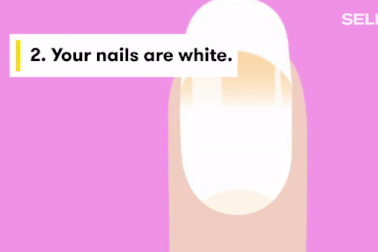 Video: Móng tay tiết lộ điều gì về sức khỏe của bạn?