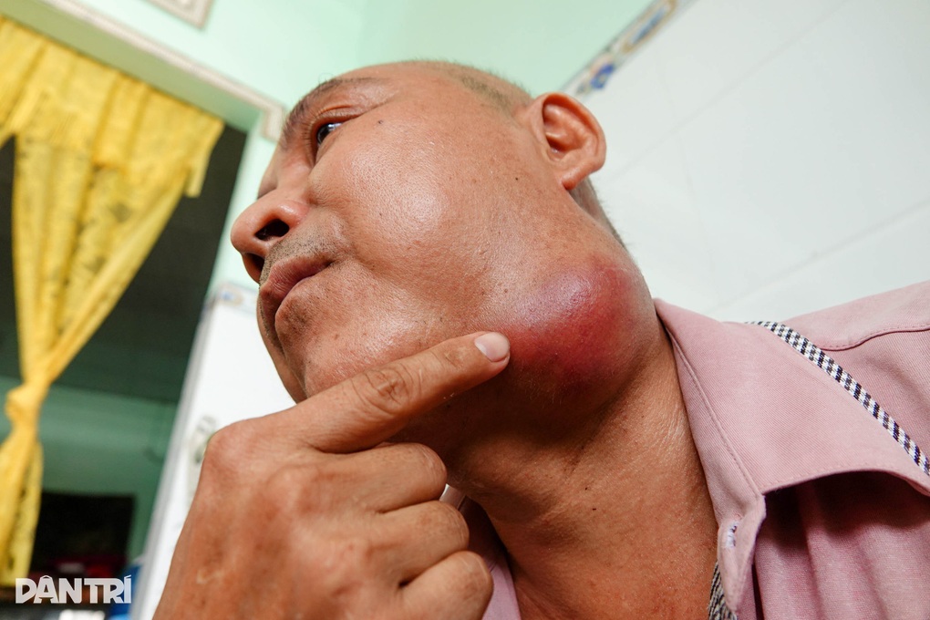 Vợ làm mướn nuôi chồng ung thư giai đoạn cuối được giúp hơn 83 triệu đồng - 2 Vợ làm mướn nuôi chồng ung thư giai đoạn cuối được giúp hơn 83 triệu đồng - 2