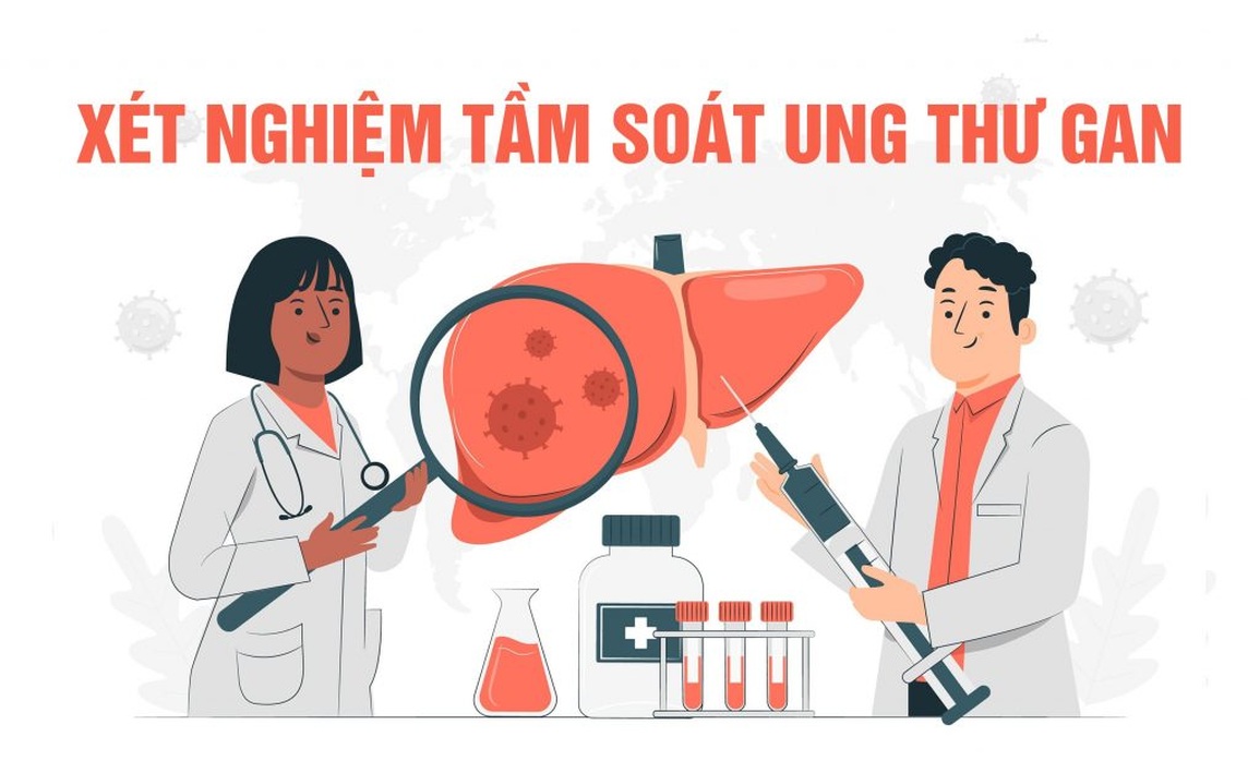 Xét nghiệm AFP có thể tầm soát ung thư gan? - 1 Xét nghiệm AFP có thể tầm soát ung thư gan? - 1