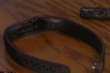 Vòng đeo tay thông minh Fitbit bất ngờ phát nổ rất nguy hiểm