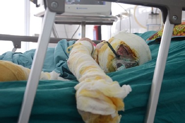 Lạnh người nhìn cậu bé như "ngọn đuốc" bởi vụ hoả hoạn bất thường!