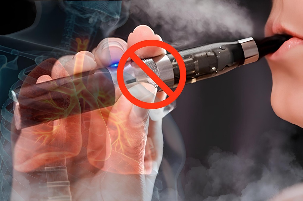 Thuốc lá điện tử đang sống khỏe trong “vùng xám” của nhận thức cộng đồng - 2 Thuốc lá điện tử đang sống khỏe trong “vùng xám” của nhận thức cộng đồng - 2