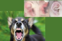 Chó cắn nát tai bé 18 tháng tuổi