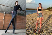 Cô gái có đôi chân dài nhất thế giới chật vật tìm người yêu