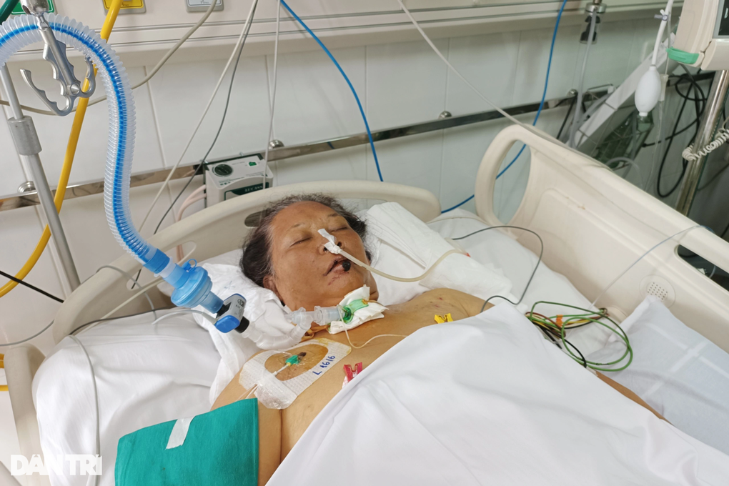 Bác sĩ BV Việt Đức kêu gọi cứu tính mạng người đàn bà nghèo khổ suy đa tạng - 2 Bác sĩ BV Việt Đức kêu gọi cứu tính mạng người đàn bà nghèo khổ suy đa tạng - 2