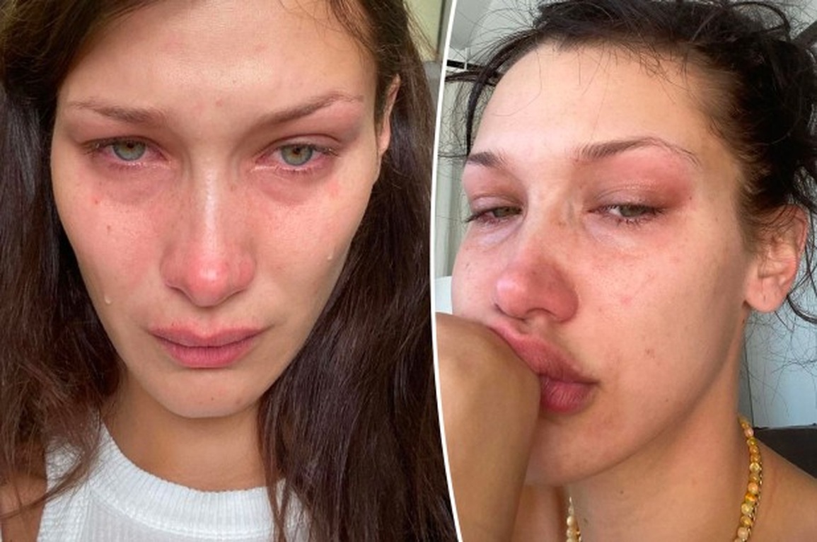 Đăng nhiều ảnh khóc lên mạng xã hội, siêu mẫu Bella Hadid muốn nói điều gì? - 1 Đăng nhiều ảnh khóc lên mạng xã hội, siêu mẫu Bella Hadid muốn nói điều gì? - 1