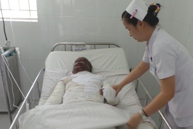 Nạn nhân đã tử vong vì bỏng điện quá nặng