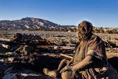 Bác sĩ kinh ngạc khi khám sức khỏe cho ông cụ "67 năm không tắm"