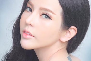 Các kiểu phẫu thuật mắt 2 mí độc quyền của Mimiclinnic