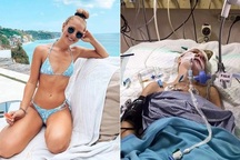 Vlogger xinh đẹp gặp tai nạn, nguy kịch ở Bali