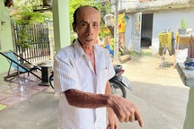 Nhân chứng ớn lạnh khi thấy bộ xương người trong bồn nước ở Đồng Nai