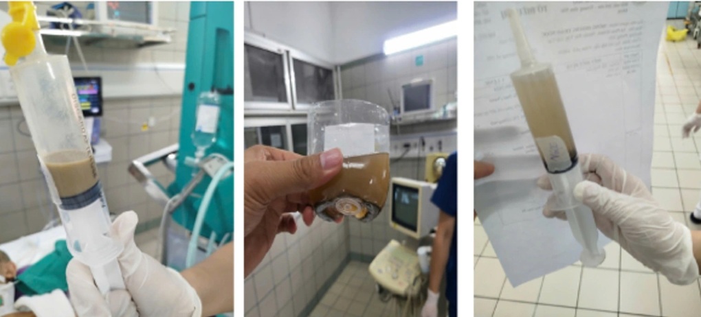 Một bệnh nhân vụ lũ quét thôn Làng Nủ đã không qua khỏi - 1 Một bệnh nhân vụ lũ quét thôn Làng Nủ đã không qua khỏi - 1