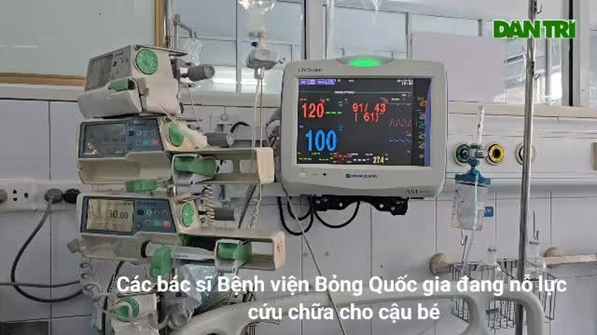 Ngã vào nồi nước sôi, bé trai 7 tuổi nguy kịch