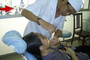 Viêm răng ảnh hưởng đến gan, thận...