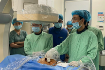 Quảng Bình lần đầu tiên triển khai thành công kỹ thuật tán sỏi mật qua da