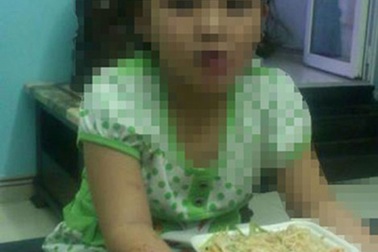 Nghi án cha ruột bạo hành con gái sáu tuổi