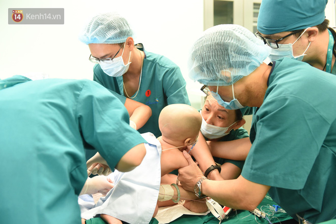 ẢNH: Khoảnh khắc xúc động trong suốt 12 tiếng phẫu thuật giúp Trúc Nhi - Diệu Nhi có được hình hài nguyên vẹn - Ảnh 8. ẢNH: Khoảnh khắc xúc động trong suốt 12 tiếng phẫu thuật giúp Trúc Nhi - Diệu Nhi có được hình hài nguyên vẹn - Ảnh 8.