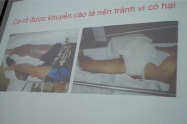 Bị rắn lục đuôi đỏ cắn: Điều trị bằng thuốc Nam là không hiệu quả