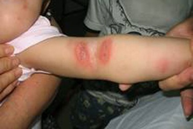 Kiến ba khoang “tấn công” dân Hà Nội