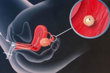 Sản xuất tinh trùng trong ống nghiệm