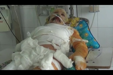 Vợ chồng anh Vinh, chị Xuân bỏng ga