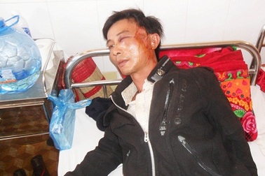 Tài xế gãy xương hàm vì bị ném đá kinh hoàng trên quốc lộ