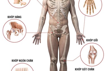 Khớp An Bình có tốt không? Mua ở đâu? Giá thế nào?