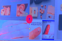 Phát hiện thiết bị gian lận thi cử siêu nhỏ, kích thước bằng nửa hạt gạo