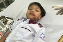 Học sinh bị chó lạ tấn công ngay cổng trường