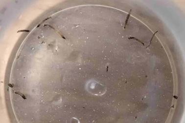 Bé gái liên tục nôn ra dòi khiến bác sĩ bối rối tìm nguyên nhân