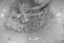 TPHCM: Đốt rác trong vườn bằng xăng, người phụ nữ bị cháy toàn thân nặng nề