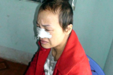 Vụ cắt tóc, lột quần tình địch: Khởi tố vợ, kỷ luật chồng