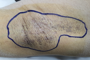 Tăng mạnh số ca vào viện cầu cứu vì bệnh gây "mất tự tin nghiêm trọng"