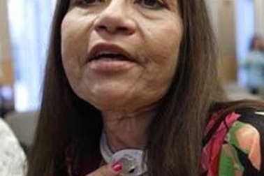 Nói được nhờ cấy ghép hộp thoại ở cổ