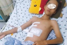 Tai nạn lao động khiến cậu bé 13 tuổi rách gan, thủng phổi