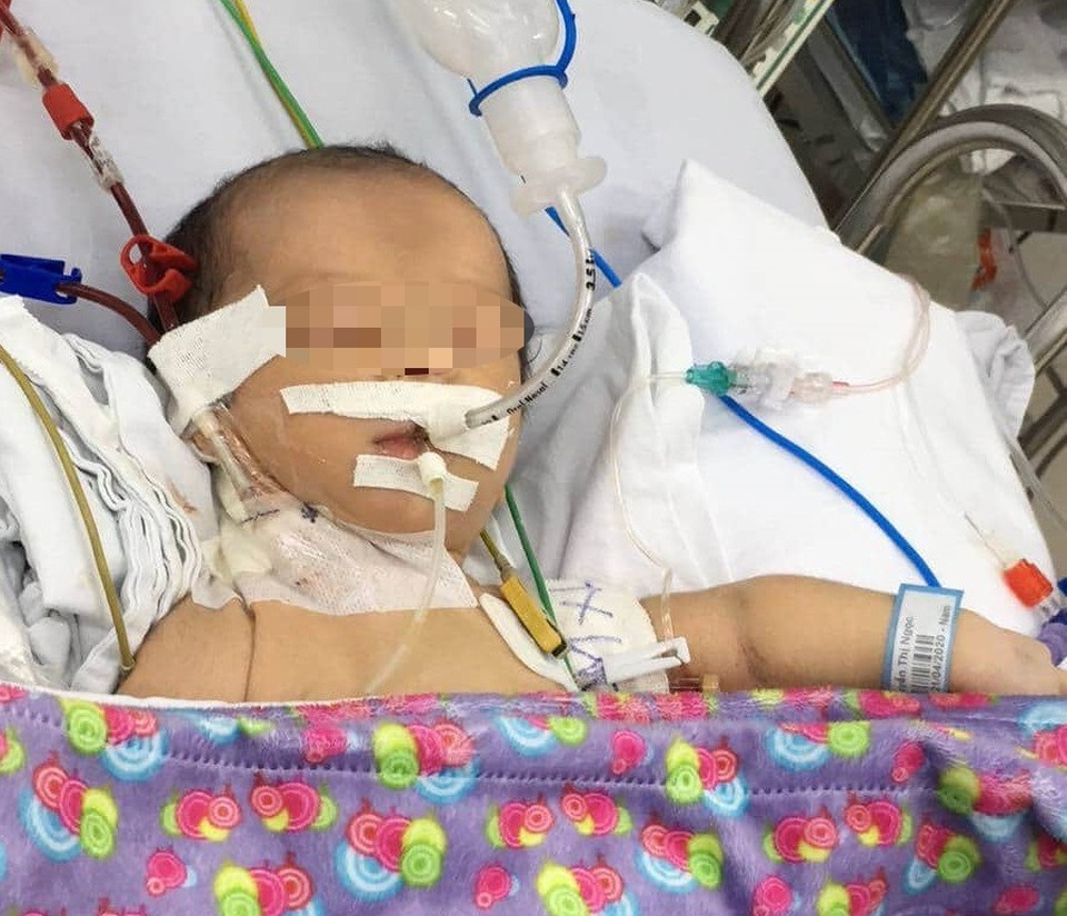 Bệnh hiếm gặp khiến bé sơ sinh co giật, hôn mê - 1