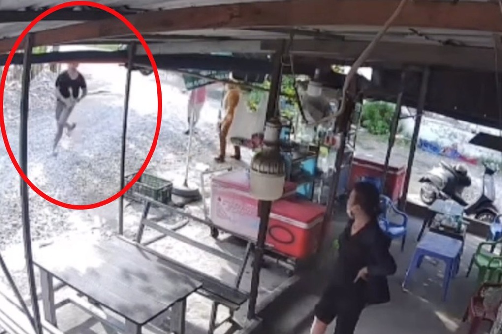 Người đàn ông ở TPHCM bị đánh trật khớp vai sau mâu thuẫn ở quán nước - 1 Người đàn ông ở TPHCM bị đánh trật khớp vai sau mâu thuẫn ở quán nước - 1