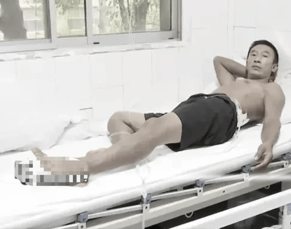 Trung Quốc: Bị sét đánh 2 lần liên tiếp, người đàn ông vẫn sống kỳ diệu - 2 Trung Quốc: Bị sét đánh 2 lần liên tiếp, người đàn ông vẫn sống kỳ diệu - 2