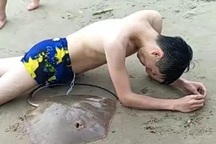Tình cảnh éo le: Đi tắm biển bị cá đuối gai độc đâm vào “chỗ hiểm”