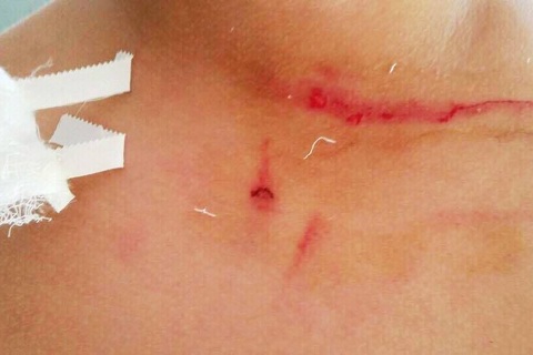 Thầy giáo thừa nhận tát, đá và đạp học sinh