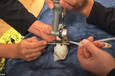 Lính cứu hỏa Đức luyện giải cứu "của quý" kẹt trong nhẫn, cổ chai