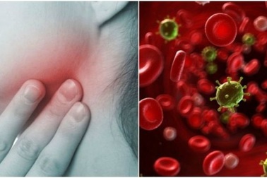 Dấu hiệu cảnh báo ung thư máu nhiều người không ngờ tới